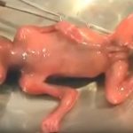 Feto abortado